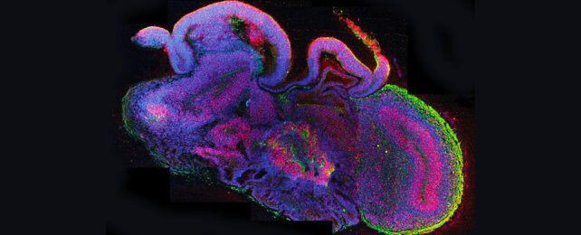 multicoloured cross section of a brain-like organoid